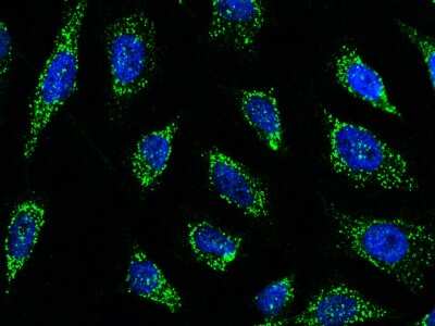 Immunocytochemistry/Immunofluorescence: Smad9 Antibody [NBP2-98884] - Immunofluorescence staining of Smad9 in Hela cells. Cells were fixed with 4% PFA, permeabilzed with 0.3% Triton X-100 in PBS, blocked with 10% serum, and incubated with rabbit anti-human Smad9 polyclonal antibody (1:5000) at 4C overnight. Then cells were stained with the Alexa Fluor(R)488-conjugated Goat Anti-rabbit IgG secondary antibody (green) and counterstained with DAPI (blue). Positive staining was localized to cytoplasm.