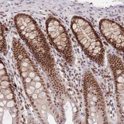 Immunohistochemistry-Paraffin: Smad9 Antibody [NBP2-38176] - Staining of human colon shows strong nuclear positivity in glandular cells.