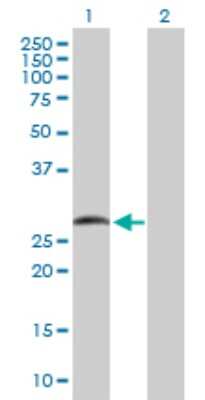 Western Blot: Smad9 Antibody [H00004093-D01P] - Analysis of SMAD9 expression in transfected 293T cell line by SMAD9 polyclonal antibody.Lane 1: SMAD9 transfected lysate(25.30 KDa).Lane 2: Non-transfected lysate.