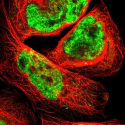 Immunocytochemistry/Immunofluorescence: Smek1 Antibody [NBP1-84664] - Immunofluorescent staining of human cell line A-431 shows localization to nucleoplasm.