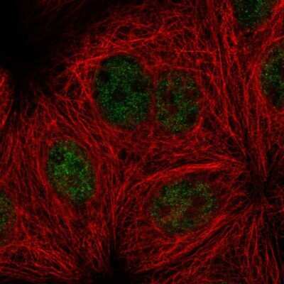 Immunocytochemistry/Immunofluorescence: Smek1 Antibody [NBP2-56478] - Staining of human cell line MCF7 shows localization to nucleoplasm.