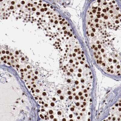 Immunohistochemistry-Paraffin: Smek1 Antibody [NBP1-84664] - Staining of human testis shows strong nuclear positivity in cells of seminiferus ducts.