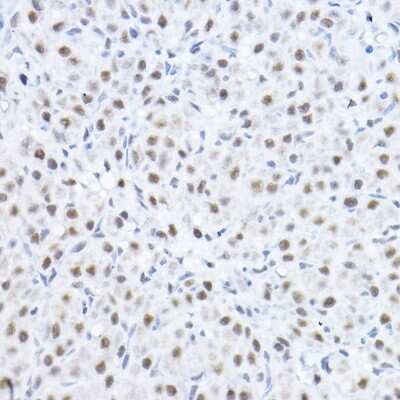 Immunohistochemistry-Paraffin Smek1 Antibody - BSA Free