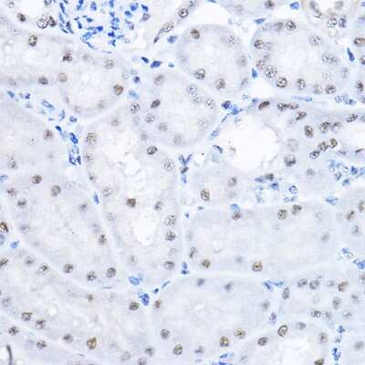 Immunohistochemistry-Paraffin: Smek1 Antibody [NBP2-94709] - Immunohistochemistry of paraffin-embedded mouse kidney using Smek1 Rabbit pAb (NBP2-94709) at dilution of 1:100 (40x lens). Perform high pressure antigen retrieval with 10 mM citrate buffer pH 6.0 before commencing with IHC staining protocol.