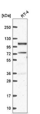 Western Blot: Smek1 Antibody [NBP2-56478] - Western blot analysis in human cell line RT-4.