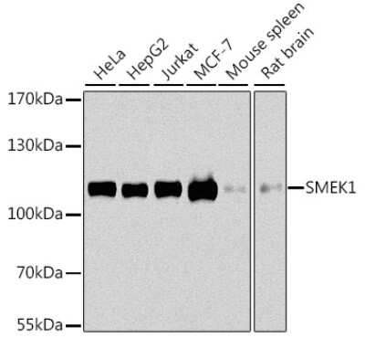 Western Blot Smek1 Antibody - BSA Free