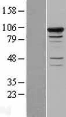 Western Blot Smek1 Overexpression Lysate