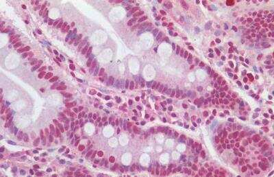 Immunohistochemistry-Paraffin: Snail Antibody [NBP3-12107] - Formalin-Fixed, Paraffin-Embedded HIER human small intestine using 10 mM sodium citrate buffer pH 6.