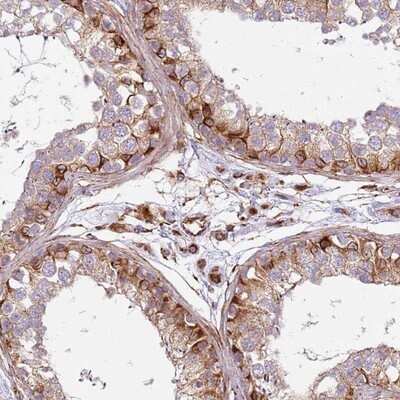 Immunohistochemistry-Paraffin: Snapin Antibody [NBP1-92414] - Staining of human testis shows strong cytoplasmic positivity in a subset of cells in seminiferus ducts.