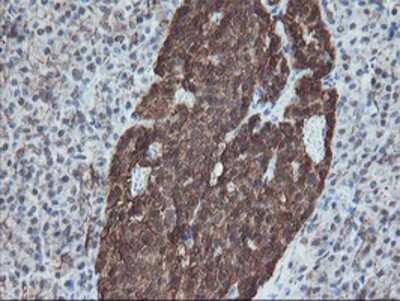 Immunohistochemistry: SnoN Antibody (OTI3E2) - Azide and BSA Free [NBP2-74255] - Staining of paraffin-embedded Human pancreas tissue using anti-SnoN mouse monoclonal antibody.
