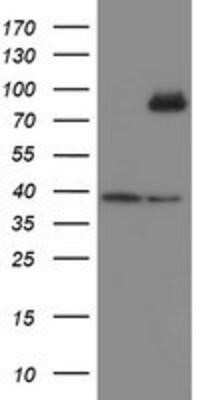 Western Blot: SnoN Antibody (OTI3E2) - Azide and BSA Free [NBP2-74255] - HEK293T cells were transfected with the pCMV6-ENTRY control (Left lane) or pCMV6-ENTRY SnoN (Right lane) cDNA for 48 hrs and lysed. Equivalent amounts of cell lysates (5 ug per lane) were separated by SDS-PAGE and immunoblotted with anti-SnoN.