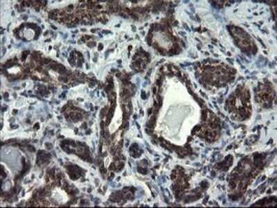 Immunohistochemistry: SnoN Antibody (OTI3F6) - Azide and BSA Free [NBP2-74254] - Analysis of Human breast tissue.
