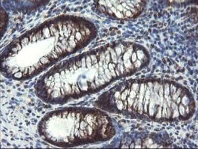 Immunohistochemistry: SnoN Antibody (OTI3F6) - Azide and BSA Free [NBP2-74254] - Analysis of Human colon tissue.
