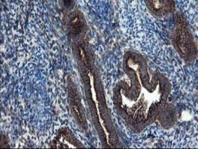 Immunohistochemistry: SnoN Antibody (OTI3F6) - Azide and BSA Free [NBP2-74254] - Analysis of Human endometrium tissue.