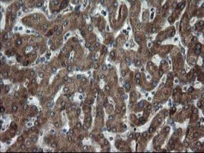 Immunohistochemistry: SnoN Antibody (OTI3F6) - Azide and BSA Free [NBP2-74254] - Analysis of Human liver tissue.