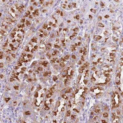 Immunohistochemistry-Paraffin: Snx6 Antibody [NBP2-13361] - Staining of human stomach, lower shows strong cytoplasmic positivity in glandular cells.