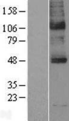 Western Blot: Sodium Iodide Symporter Overexpression Lysate (Adult Normal) [NBP2-04158] Left-Empty vector transfected control cell lysate (HEK293 cell lysate); Right -Over-expression Lysate for Sodium Iodide Symporter.