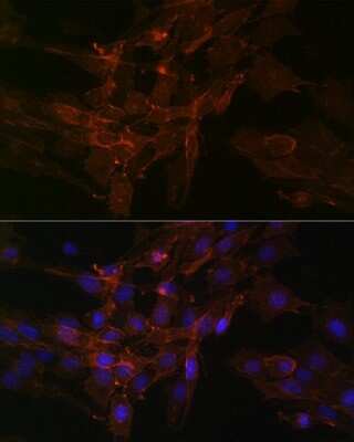 Immunocytochemistry/Immunofluorescence: Sodium Potassium ATPase Alpha 1 Antibody (3L6F0) [NBP3-15427] - Immunofluorescence analysis of C6 cells using Sodium Potassium ATPase Alpha 1 Rabbit mAb (NBP3-15427) at dilution of 1:100 (40x lens). Blue: DAPI for nuclear staining.