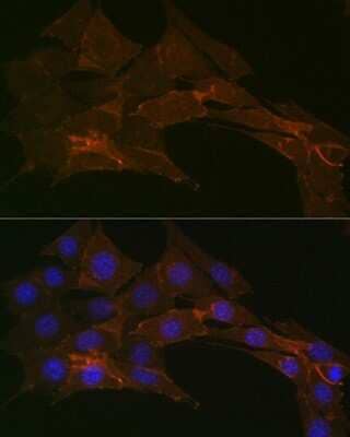 Immunocytochemistry/Immunofluorescence: Sodium Potassium ATPase Alpha 1 Antibody (3L6F0) [NBP3-15427] - Immunofluorescence analysis of NIH-3T3 cells using Sodium Potassium ATPase Alpha 1 Rabbit mAb (NBP3-15427) at dilution of 1:100 (40x lens). Blue: DAPI for nuclear staining.