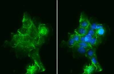 <b>Independent Antibodies Validation. </b>Immunocytochemistry/Immunofluorescence: Sodium Potassium ATPase Alpha 1 Antibody (HL114) [NBP3-13660] - Sodium Potassium ATPase Alpha 1 antibody [HL114] detects Sodium Potassium ATPase Alpha 1 protein at cell membrane by immunofluorescent analysis. Sample: A431 cells were fixed in ice-cold MeOH for 5 min. Green: Sodium Potassium ATPase Alpha 1 stained by Sodium Potassium ATPase Alpha 1 antibody [HL114] (NBP3-13660) diluted at 1:500. Blue: Fluoroshield with DAPI.