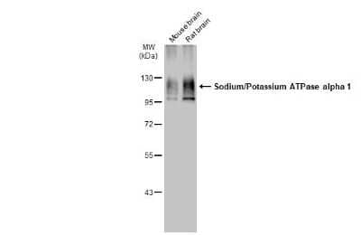 Western Blot: Sodium Potassium ATPase Alpha 1 Antibody (HL114) [NBP3-13660] - Various tissue extracts (50 ug) were separated by 7.5% SDS-PAGE, and the membrane was blotted with Sodium Potassium ATPase Alpha 1 antibody [HL114] (NBP3-13660) diluted at 1:50000. The HRP-conjugated anti-rabbit IgG antibody (NBP2-19301) was used to detect the primary antibody.