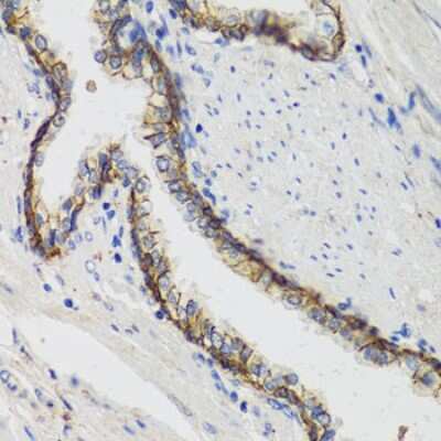 Immunohistochemistry-Paraffin: Sodium Potassium ATPase Alpha 1 Antibody [NBP2-95089] - Human prostate using ATP1A1 antibody at dilution of 1:100 (40x lens).