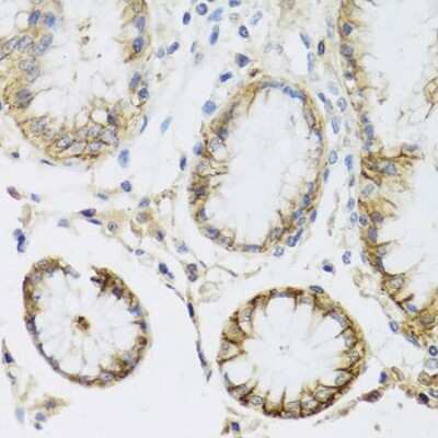 Immunohistochemistry-Paraffin: Sodium Potassium ATPase Alpha 1 Antibody [NBP2-95089] - Human stomach using ATP1A1 antibody at dilution of 1:100 (40x lens).