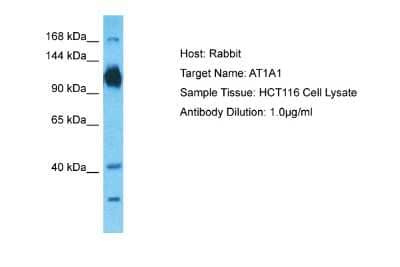 Western Blot: Sodium Potassium ATPase Alpha 1 Antibody [NBP2-84601] - Host: Rabbit. Target Name: AT1A1. Sample Type: HCT116 Whole Cell lysates. Antibody Dilution: 1.0ug/ml