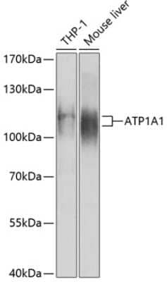 Western Blot: Sodium Potassium ATPase Alpha 1 Antibody [NBP2-95257] - Analysis of extracts of various cell lines, using Sodium Potassium ATPase Alpha 1 at 1:1000 dilution.Secondary antibody: HRP Goat Anti-Rabbit IgG (H+L) at 1:10000 dilution.Lysates/proteins: 25ug per lane.Blocking buffer: 3% nonfat dry milk in TBST.Detection: ECL Basic Kit .Exposure time: 15s.