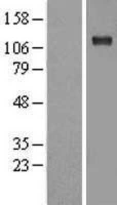 Western Blot: Sodium Potassium ATPase Alpha 1 Overexpression Lysate (Adult Normal) [NBL1-07807] Left-Empty vector transfected control cell lysate (HEK293 cell lysate); Right -Over-expression Lysate for Sodium Potassium ATPase Alpha 1.