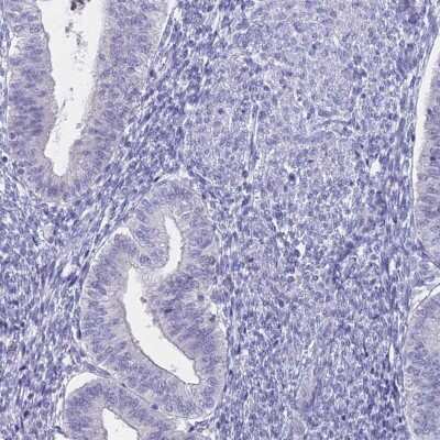 Immunohistochemistry-Paraffin: Sodium Potassium ATPase Alpha 3 Antibody [NBP2-37913] - Staining of human endometrium shows low expression as expected.