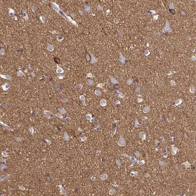 Immunohistochemistry-Paraffin: Sodium Potassium ATPase Alpha 3 Antibody [NBP2-37955] - Staining of human cerebral cortex shows  strong positivity in neuropil.