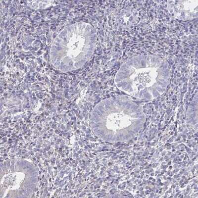 <b>Orthogonal Strategies Validation. </b>Immunohistochemistry-Paraffin: Sodium Potassium ATPase Alpha 3 Antibody [NBP2-37955] - Staining of human endometrium shows no positivity in glandular cells as expected.