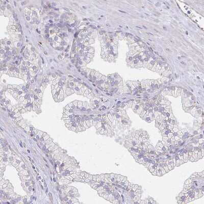 Immunohistochemistry-Paraffin: Sodium Potassium ATPase Alpha 3 Antibody [NBP2-37955] - Staining of human prostate shows no positivity in glandular cells as expected.