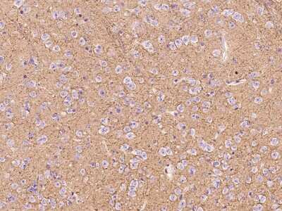 Immunohistochemistry-Paraffin: Sodium Potassium ATPase Alpha 3 Antibody [NBP2-99238] - Immunochemical staining of mouse Sodium Potassium ATPase Alpha 3 in mouse brain with rabbit polyclonal antibody at 1:300 dilution, formalin-fixed paraffin embedded sections.