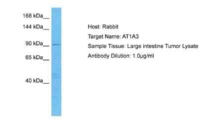 Western Blot: Sodium Potassium ATPase Alpha 3 Antibody [NBP2-88330] - WB Suggested Anti-AT1A3 antibody Titration: 1 ug/mL. Sample Type: Human Large intestine Tumor