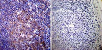 Immunohistochemistry-Paraffin: Sodium Potassium ATPase Alpha 3 Antibody (XVIF9-G10) [NB300-540] - Both normal and cancer biopsies of deparaffinized Human tonsil tissues.