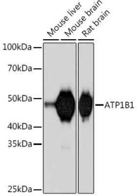 Western Blot: Sodium Potassium ATPase Beta 1 Antibody (4M5T3) [NBP3-16560] - Western blot analysis of extracts of various cell lines, using Sodium Potassium ATPase Beta 1 Rabbit mAb (NBP3-16560) at 1:1000 dilution. Secondary antibody: HRP Goat Anti-Rabbit IgG (H+L) at 1:10000 dilution. Lysates/proteins: 25ug per lane. Blocking buffer: 3% nonfat dry milk in TBST. Detection: ECL Basic Kit. Exposure time: 90s.
