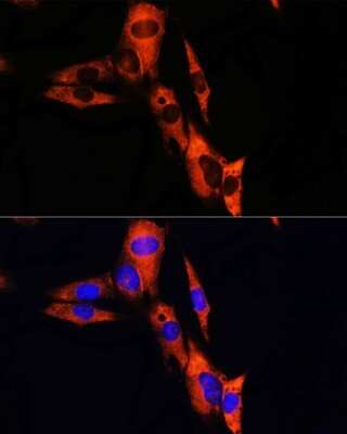 Immunocytochemistry/Immunofluorescence: Sodium Potassium ATPase Beta 1 Antibody [NBP2-95095] - Analysis of NIH/3T3 cells using Sodium Potassium ATPase Beta 1 at dilution of 1:100. Blue: DAPI for nuclear staining.