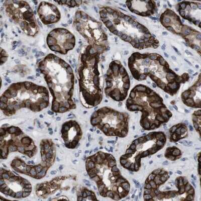 Immunohistochemistry-Paraffin: Sodium Potassium ATPase Beta 1 Antibody [NBP2-54665] - Staining of human kidney shows high expression.