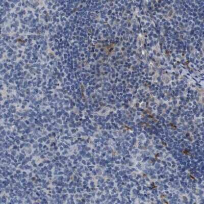 Immunohistochemistry-Paraffin: Sodium Potassium ATPase Beta 1 Antibody [NBP2-54665] - Staining of human lymph node shows low expression as expected.