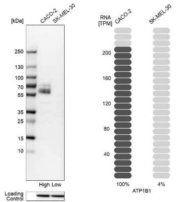 <b>Orthogonal Strategies Validation. </b>Western Blot: Sodium Potassium ATPase Beta 1 Antibody [NBP2-54665] - Analysis in human cell lines Caco-2 and SK-MEL-30 using anti-ATP1B1 antibody. Corresponding ATP1B1 RNA-seq data are presented for the same cell lines. Loading control: anti-HDAC1.