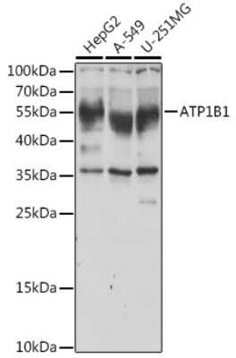 Western Blot: Sodium Potassium ATPase Beta 1 Antibody [NBP2-95093] - Analysis of extracts of various cell lines, using Sodium Potassium ATPase Beta 1 at 1:1000 dilution.Secondary antibody: HRP Goat Anti-Rabbit IgG (H+L) at 1:10000 dilution.Lysates/proteins: 25ug per lane.Blocking buffer: 3% nonfat dry milk in TBST.Detection: ECL Basic Kit .Exposure time: 3s.