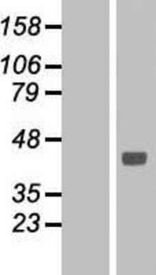 Western Blot: Sodium Potassium ATPase Beta 1 Overexpression Lysate (Adult Normal) [NBL1-07811] Left-Empty vector transfected control cell lysate (HEK293 cell lysate); Right -Over-expression Lysate for Sodium Potassium ATPase Beta 1.