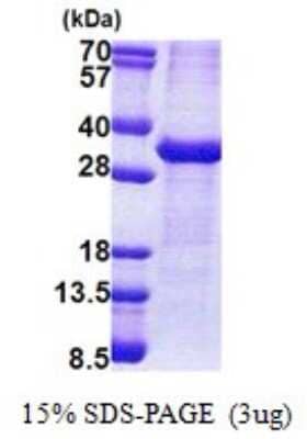 SDS-Page: Sodium Potassium ATPase Beta 1 Recombinant Protein [NBP2-53034] - 15% SDS-PAGE (3ug)