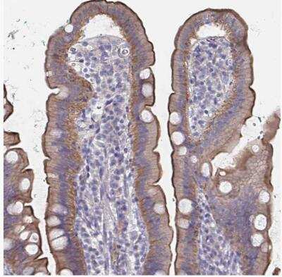 Immunohistochemistry-Paraffin: Somatostatin R1/SSTR1 Antibody [NBP2-34203] -  Staining of human upper gastrointestinal shows moderate to strong positivity in luminal membrane in glandular cells.