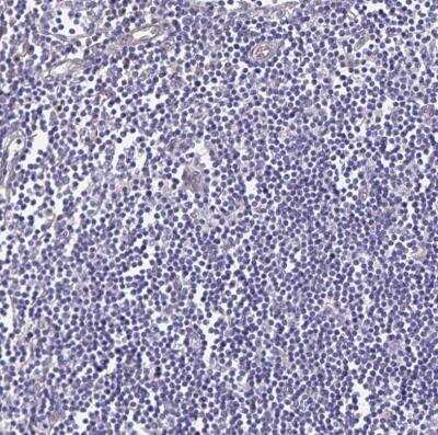 Immunohistochemistry-Paraffin: Somatostatin R1/SSTR1 Antibody [NBP2-34203] -  Staining of human lymph node shows no positivity in non - germinal center cells as expected.