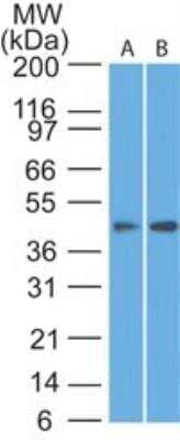 Western Blot: Somatostatin R1/SSTR1 Antibody [NBP2-27413] -  Analysis in human A) lung and B) pancreas lysate using SSTR1 antibody at 3 ug/ml.