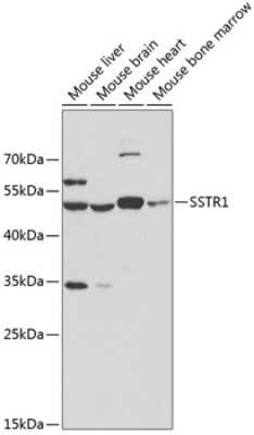 Western Blot: Somatostatin R1/SSTR1 Antibody [NBP2-94605] - Analysis of extracts of various cell lines, using Somatostatin R1/SSTR1 .