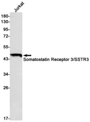 Western Blot: Somatostatin R3/SSTR3 Antibody (S08-2G8) [NBP3-19777] - Western blot detection of Somatostatin R3/SSTR3 in Jurkat cell lysates using NBP3-19777 (1:500 diluted). Predicted band size: 46kDa. Observed band size: 46kDa.